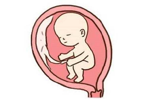 为什么要做试管婴儿？试管婴儿适合哪类人群？