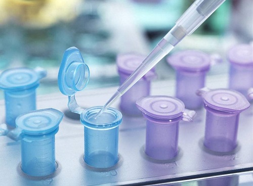 俄罗斯做试管婴儿到孕晚期如何去判断胎儿是否缺氧呢