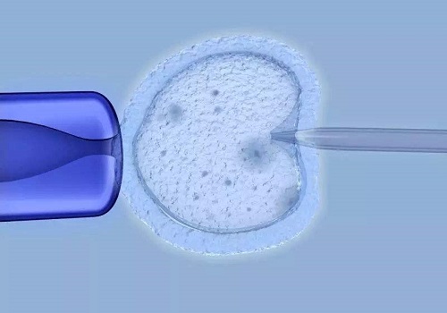 美国试管婴儿助孕生子全过程